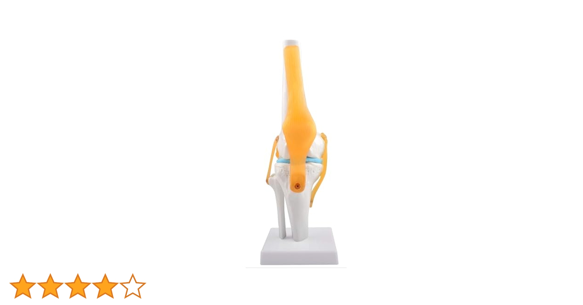 ロキソニン　変形性膝関節症 人体模型 約21cm ロキソニン 変形性膝関節症 人体模型 約21cm ロキソニン 変形性